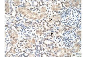 ST8SIA2 antibody was used for immunohistochemistry at a concentration of 4-8 ug/ml to stain Epithelial cells of renal tubule (arrows) in Human Kidney. (ST8SIA2 Antikörper  (C-Term))