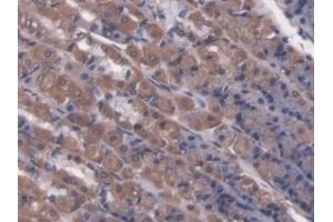 Detection of LCT in Rat Stomach Tissue using Polyclonal Antibody to Lactase (LCT) (LCT Antikörper  (AA 33-291))