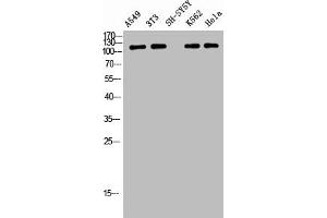Western Blot analysis of A549 NIH-3T3 SH-SY5Y K562 HELA cells using Phospho-Tensin-2 (Y483) Polyclonal Antibody (TENC1 Antikörper  (pTyr483))