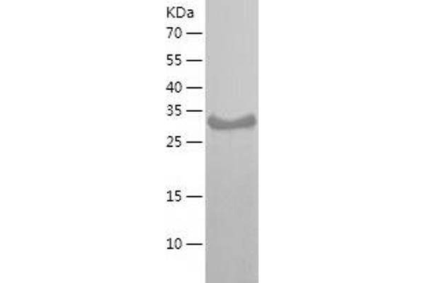 NOV Protein (AA 28-357) (His tag)