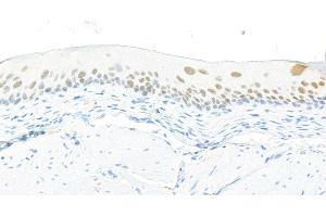 Immunohistochemistry (IHC) image for anti-Forkhead Box Q1 (FOXQ1) (AA 353-403) antibody (ABIN7455177) (Rekombinanter FOXQ1 Antikörper  (AA 353-403))