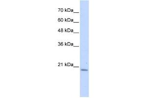 WB Suggested Anti-PFDN6 Antibody Titration: 0.