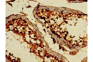 Immunohistochemistry of paraffin-embedded human testis tissue using ABIN7174832 at dilution of 1:100 (C3ORF14 Antikörper  (AA 9-128))