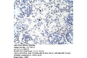 Human kidney (GMEB2 Antikörper  (C-Term))