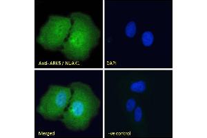 ABIN570930 Immunofluorescence analysis of paraformaldehyde fixed U2OS cells, permeabilized with 0. (NUAK1 Antikörper  (Internal Region))