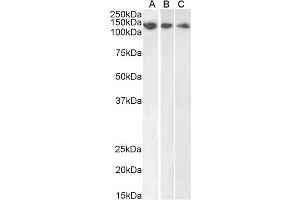 ABIN184570 (1µg/ml) staining of HeLa (A), HepG2 (B) and Jurkat (C) lysate (35µg protein in RIPA buffer). (DDB1 Antikörper  (C-Term))