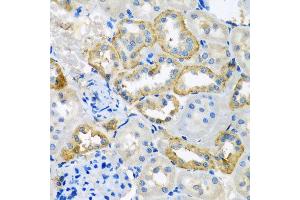 Immunohistochemistry of paraffin-embedded rat kidney using UQCR10 antibody at dilution of 1:100 (x40 lens). (UQCR10 Antikörper)