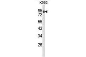 Western blot analysis of IL1RAPL2 Antibody (Center) in K562 cell line lysates (35ug/lane).