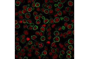 Immunohistochemistry (IHC) image for anti-Protein tyrosine Phosphatase, Receptor Type, C (PTPRC) antibody (ABIN6940470)