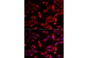 Immunofluorescence analysis of HeLa cell using SERPINB9 antibody. (SERPINB9 Antikörper)