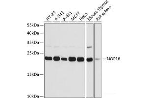 Western blot analysis of extracts of various cell lines using NOP16 Polyclonal Antibody at dilution of 1:3000.