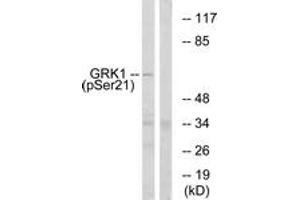 Western blot analysis of extracts from COS7 cells treated with TNF 20ng/ml 5', using GRK1 (Phospho-Ser21) Antibody. (GRK1 Antikörper  (pSer21))