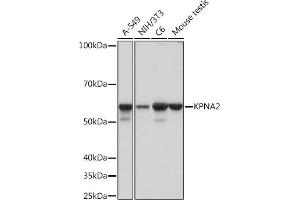 Western blot analysis of extracts of various cell lines, using KPN Rabbit mAb (ABIN1680520, ABIN3019328, ABIN3019329 and ABIN7101751) at 1:1000 dilution.
