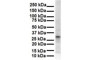 WB Suggested Anti-ECHDC2 antibody Titration: 1 ug/mL Sample Type: Human 721_B (ECHDC2 Antikörper  (Middle Region))