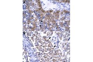 Immunohistochemical staining (Formalin-fixed paraffin-embedded sections) of human liver (A) and human muscle (B) with ERCC8 polyclonal antibody  at 4-8 ug/mL working concentration. (ERCC8 Antikörper  (C-Term))