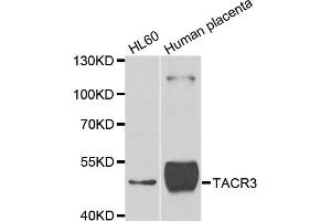 Western blot analysis of extracts of various cell lines, using TACR3 antibody. (TACR3 Antikörper)