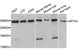 Western blot analysis of extracts of various cell lines, using SPTA1 antibody. (SPTA1 Antikörper  (AA 940-1160))