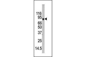 ATG7 Antikörper  (C-Term)