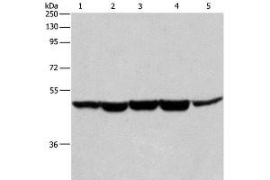 Western Blot analysis of Human bladder cancer tissue, A375, K562, Hela and HepG2 cell using HNRNP F Polyclonal Antibody at dilution of 1:350 (HNRNPF Antikörper)