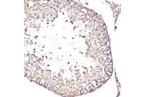 Immunohistochemistry (IHC) image for anti-Selectin L (SELL) (AA 1-100) antibody (ABIN3022264)