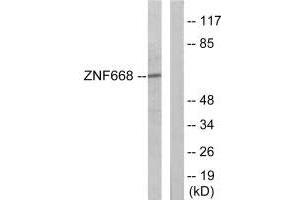 Western blot analysis of extracts from Jurkat cells, using ZNF668 antibody. (ZNF668 Antikörper)