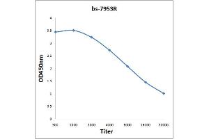 Antigen: 0. (AKR1A1 Antikörper  (AA 53-130))