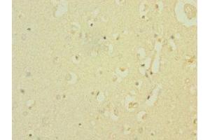 Immunohistochemistry of paraffin-embedded human brain tissue using ABIN7169927 at dilution of 1:100 (SCN8A Antikörper  (AA 1350-1440))