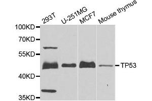 Western blot analysis of extracts of various cells, using TP53 antibody. (p53 Antikörper)