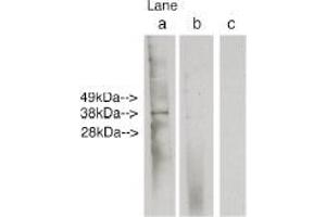 Image no. 1 for anti-Ceramide Synthase 6 (CERS6) antibody (ABIN265213) (CERS6 Antikörper)
