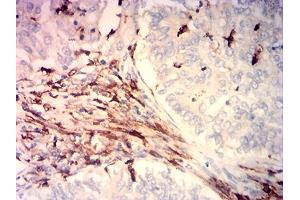 Immunohistochemistry (IHC) image for anti-CD14 (CD14) (AA 230-345) antibody (ABIN7193493)