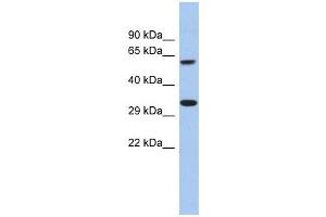 FAM26A antibody used at 1 ug/ml to detect target protein. (CALHM3 Antikörper  (C-Term))