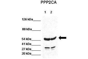 WB Suggested Anti-PPP2CA Antibody  Positive Control: Lane 1:441 µg HEK293 lysate Lane 2: 041 µg H1299 lysate Primary Antibody Dilution: 1:0000Secondary Antibody: Goat anti-rabbit-HRP Secondry  Antibody Dilution: 1:0000Submitted by: Jose Luis Rosa, Universitat de Barcelona (PPP2CA Antikörper  (N-Term))