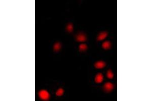 Immunofluorescent analysis of p14 ARF staining in K562 cells.