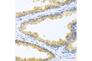 Immunohistochemistry of paraffin-embedded human prostate using KLK11 antibody (ABIN6291422) at dilution of 1:100 (40x lens). (Kallikrein 11 Antikörper)