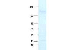 Western Blotting (WB) image for Apoptosis Antagonizing Transcription Factor (AATF) protein (DYKDDDDK Tag) (ABIN2714258)