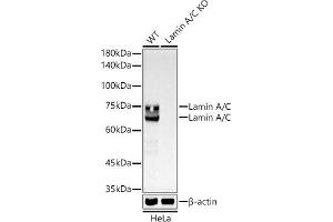 Western Blotting (WB) image for anti-Lamin A/C (LMNA) antibody (ABIN7268177)