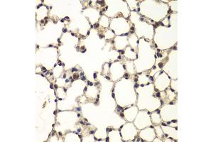 Immunohistochemistry of paraffin-embedded mouse lung using PHF11 antibody (ABIN6290738) at dilution of 1:100 (40x lens). (PHF11 Antikörper)