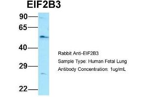 Western Blotting (WB) image for anti-Eukaryotic Translation Initiation Factor 2B, Subunit 3 Gamma, 58kDa (EIF2B3) (Middle Region) antibody (ABIN2790398)
