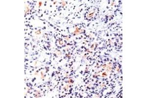 Image no. 1 for anti-Folate Hydrolase (Prostate-Specific Membrane Antigen) 1 (FOLH1) antibody (ABIN372967) (PSMA Antikörper)