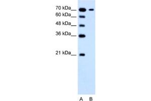 Western Blotting (WB) image for anti-Solute Carrier Family 5 (Low Affinity Glucose Cotransporter), Member 4 (SLC5A4) antibody (ABIN2462755) (SLC5A4 Antikörper)