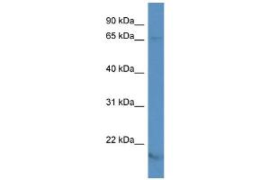 WB Suggested Anti-KCNA5 Antibody Titration: 1. (KCNA5 Antikörper  (N-Term))