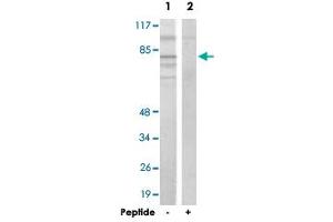 Western blot analysis of extracts from 293 cells, using ADD2 polyclonal antibody . (ADD2 Antikörper)