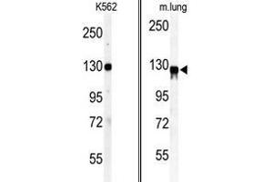 (LEFT) Western blot analysis of anti-VINC Antibody (N-term) in K562 cell line lysates (35ug/lane). (Vinculin Antikörper  (N-Term))