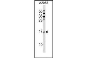 Western blot analysis of NAT5 Antibody (C-term) in A2058 cell line lysates (35ug/lane). (NAT5 Antikörper  (C-Term))