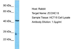 Host: Rabbit Target Name: ZCCHC18 Sample Tissue: Human HCT15 Whole Cell  Antibody Dilution: 1ug/ml (ZCCHC18 Antikörper  (C-Term))
