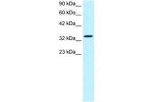 Western Blotting (WB) image for anti-SMAD, Mothers Against DPP Homolog 6 (SMAD6) antibody (ABIN2460536) (SMAD6 Antikörper)