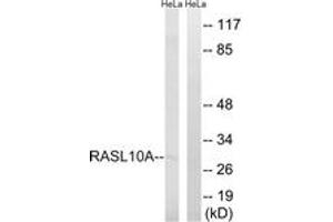 Western Blotting (WB) image for anti-RAS-Like, Family 10, Member A (RASL10A) (AA 107-156) antibody (ABIN2890571) (RASL10A Antikörper  (AA 107-156))