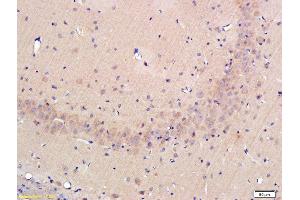Formalin-fixed and paraffin-embedded rat hippocampus labeled with Rabbit Anti-OPN Polyclonal Antibody, Unconjugated (ABIN723800) at 1:300 followed by conjugation to the secondary antibody (Osteopontin Antikörper  (AA 221-280))