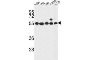Western blot analysis in WiDr,Y79,293,A2058,A375 cell line lysates (35ug/lane) using GPR180/ITR Antibody . (GPR180 Antikörper  (Middle Region))
