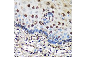 Immunohistochemistry of paraffin-embedded Human esophageal using FCF1 Rabbit pAb (ABIN7267162) at dilution of 1:100 (40x lens). (FCF1 Antikörper)